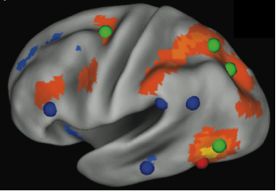 Figure 1: The left hemisphere of the brain. The VWFA (red sphere) is shown with parts of the brain that correlate with VWFA activity (orange regions). The VWFA functional connectivity pattern overlaps more with dorsal attention regions (green spheres) than reading-related regions (blue spheres). From Vogel et al. (2012).